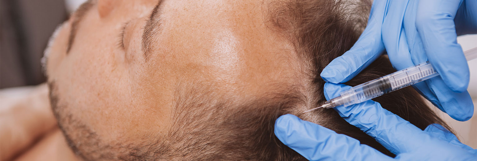 Balding man getting hairloss treatment injections