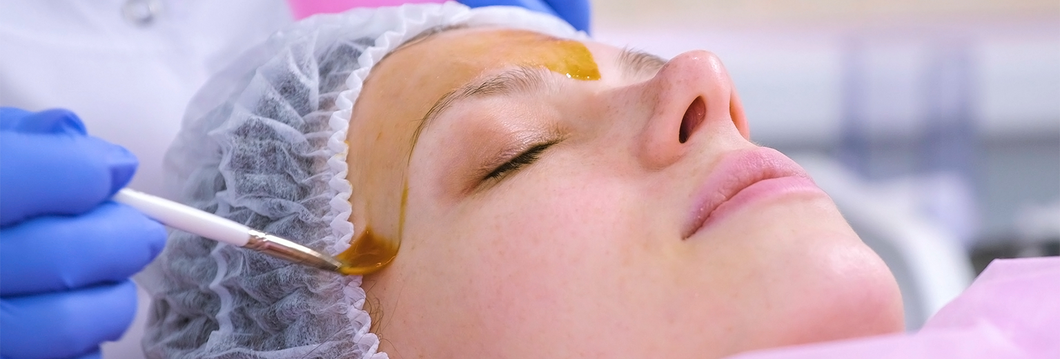 Lady having a chemical peeling treatmnent